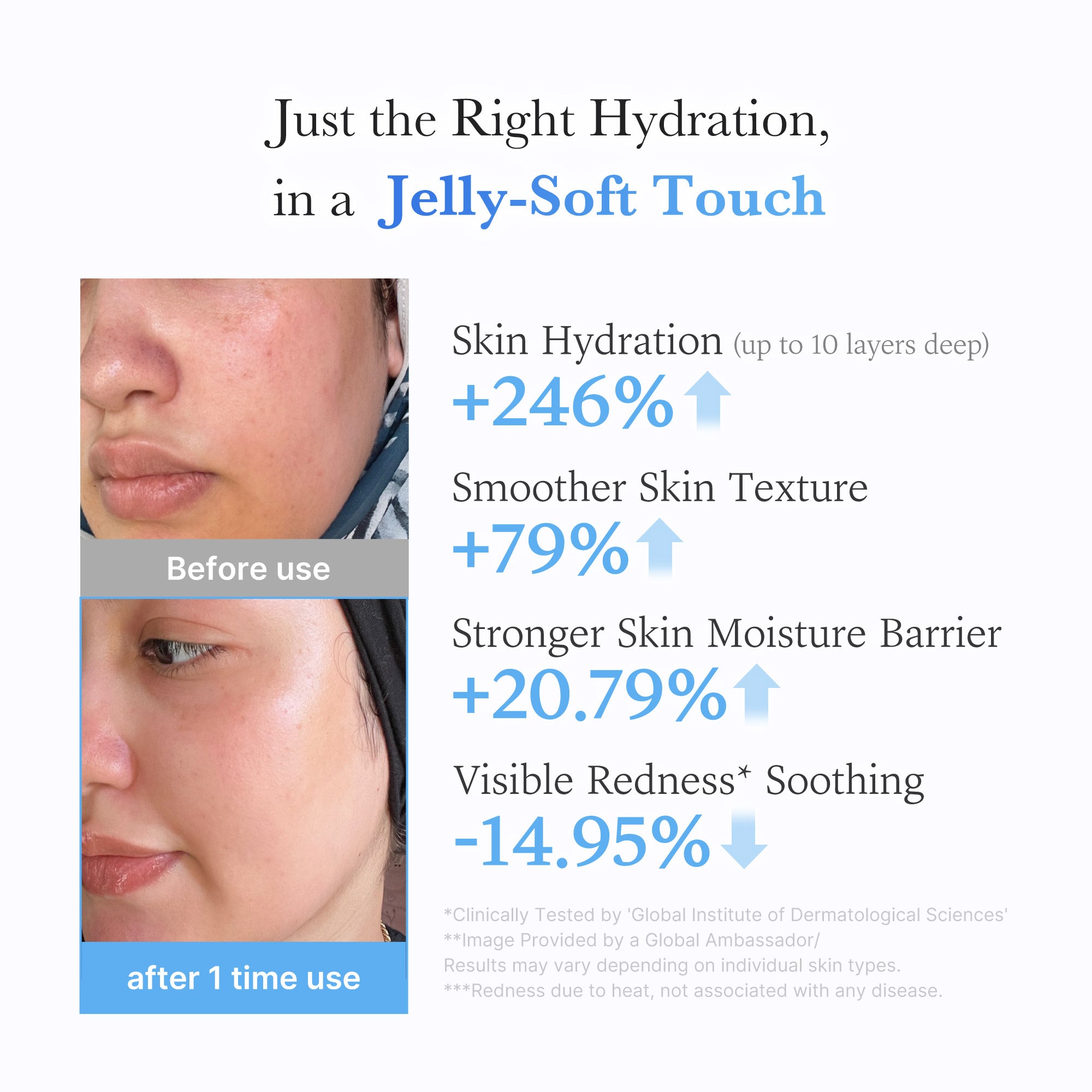 hyaluronic ceramide moisturizing jelly cream