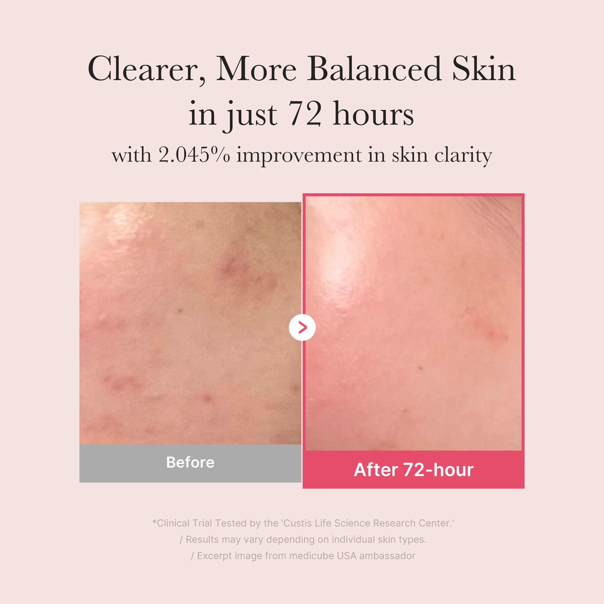 txa niacinamide serum