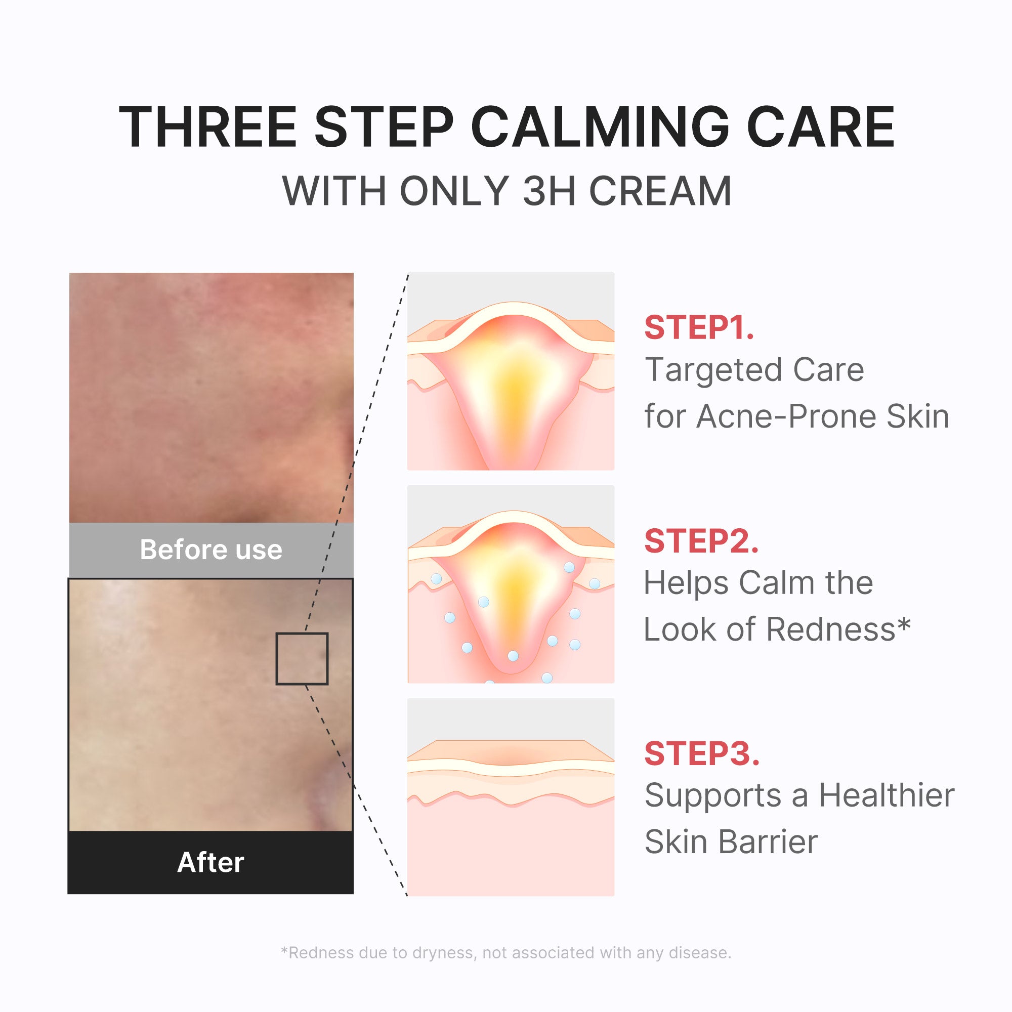 medicube 3h daily relief cream